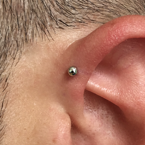 Forward helix
